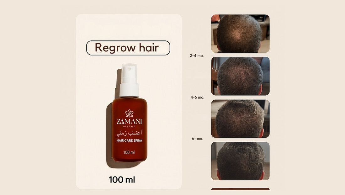 Zamani Herbal Hair Fall & Dandruff Control Spray 