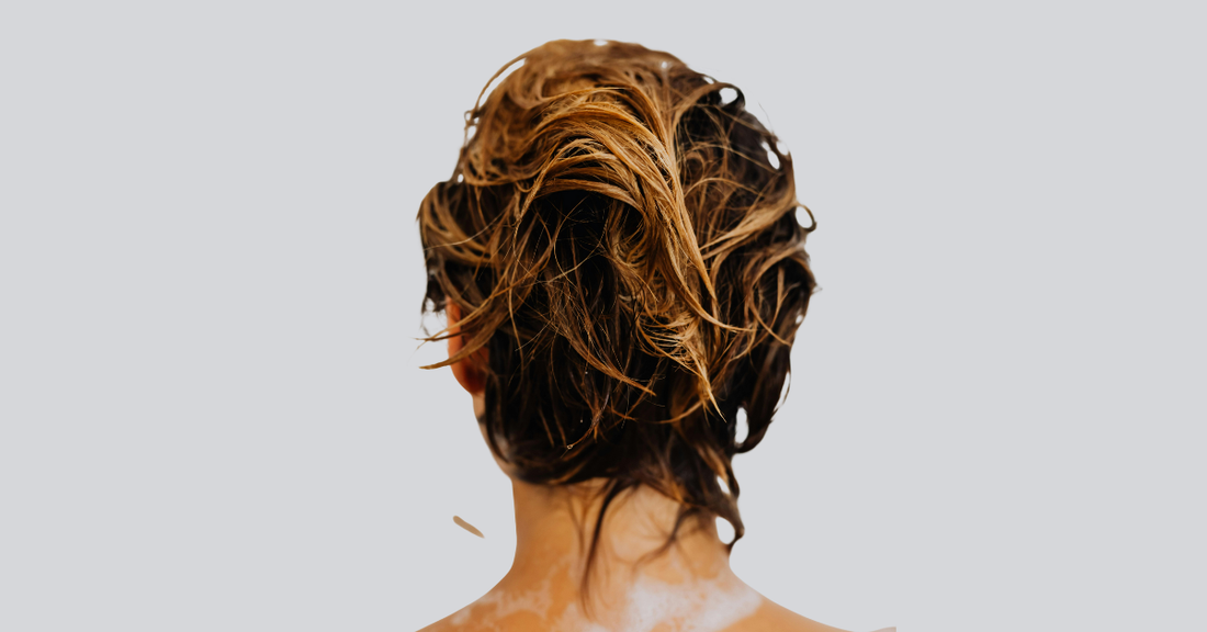 Natural dandruff solution for UAE – Zamani Herbal Hair Care Spray