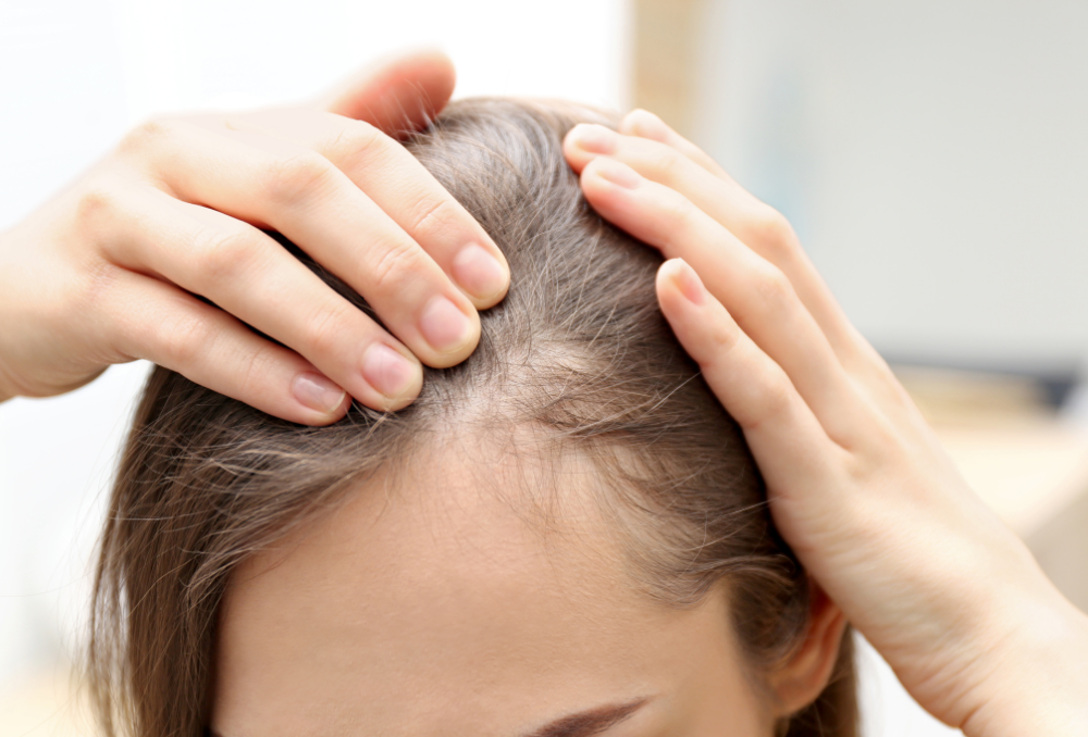 anti-dandruff-herbal-spray