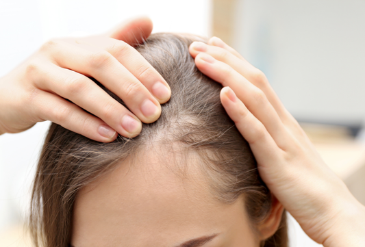 anti-dandruff-herbal-spray