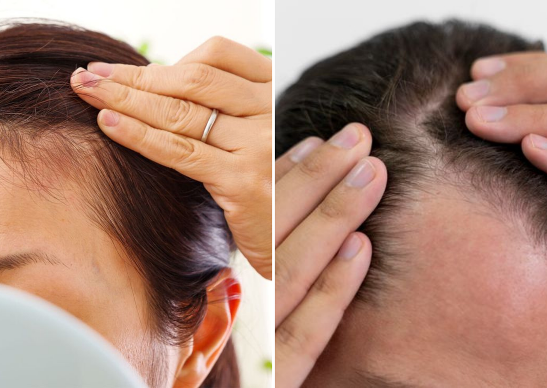 How Hormones Affect Hair Health (For Men & Women)